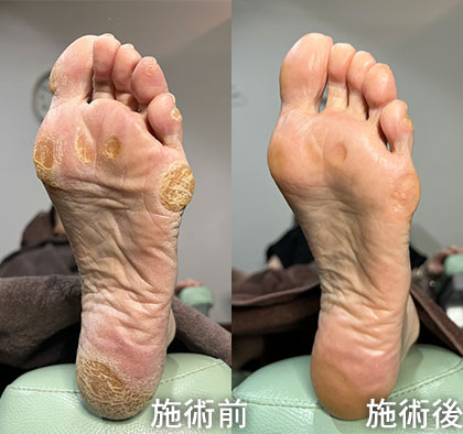 足のトラブルコース